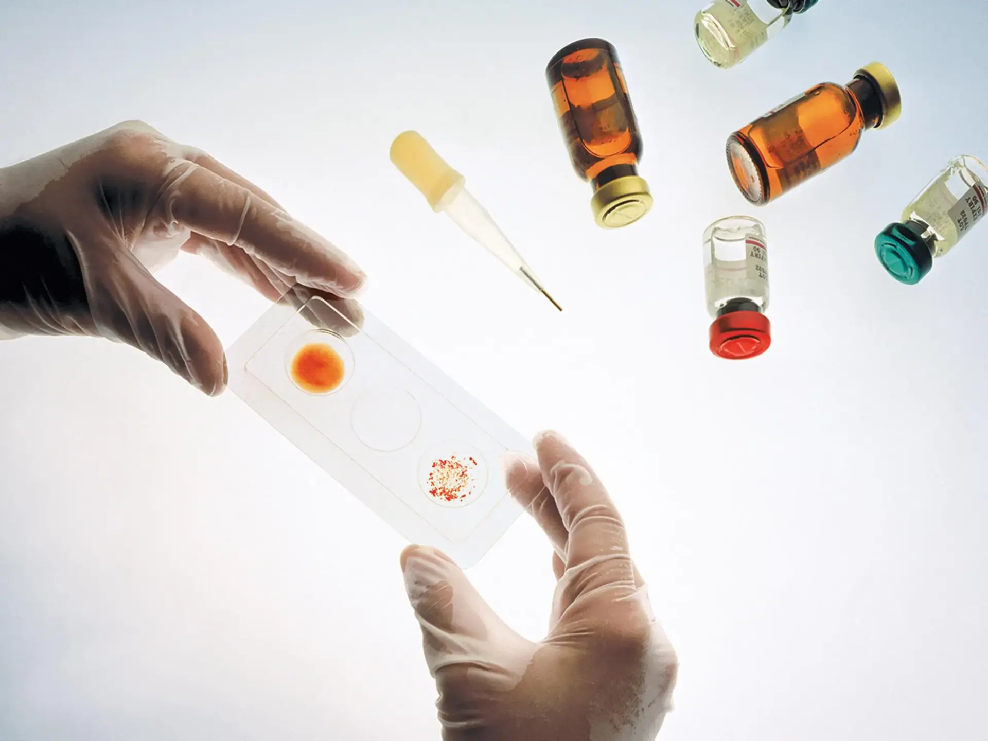 درمان ویروس HIV نزدیک تر از همیشه !