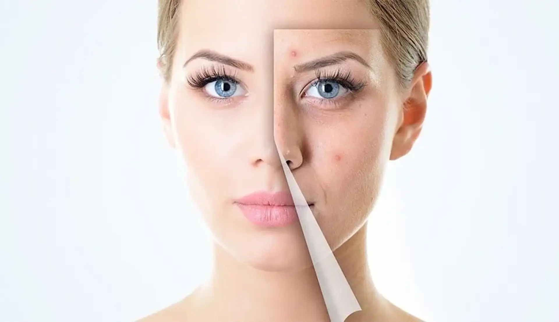 برای داشتن پوست صاف و بدون جوش از این روش ها استفاده کنید