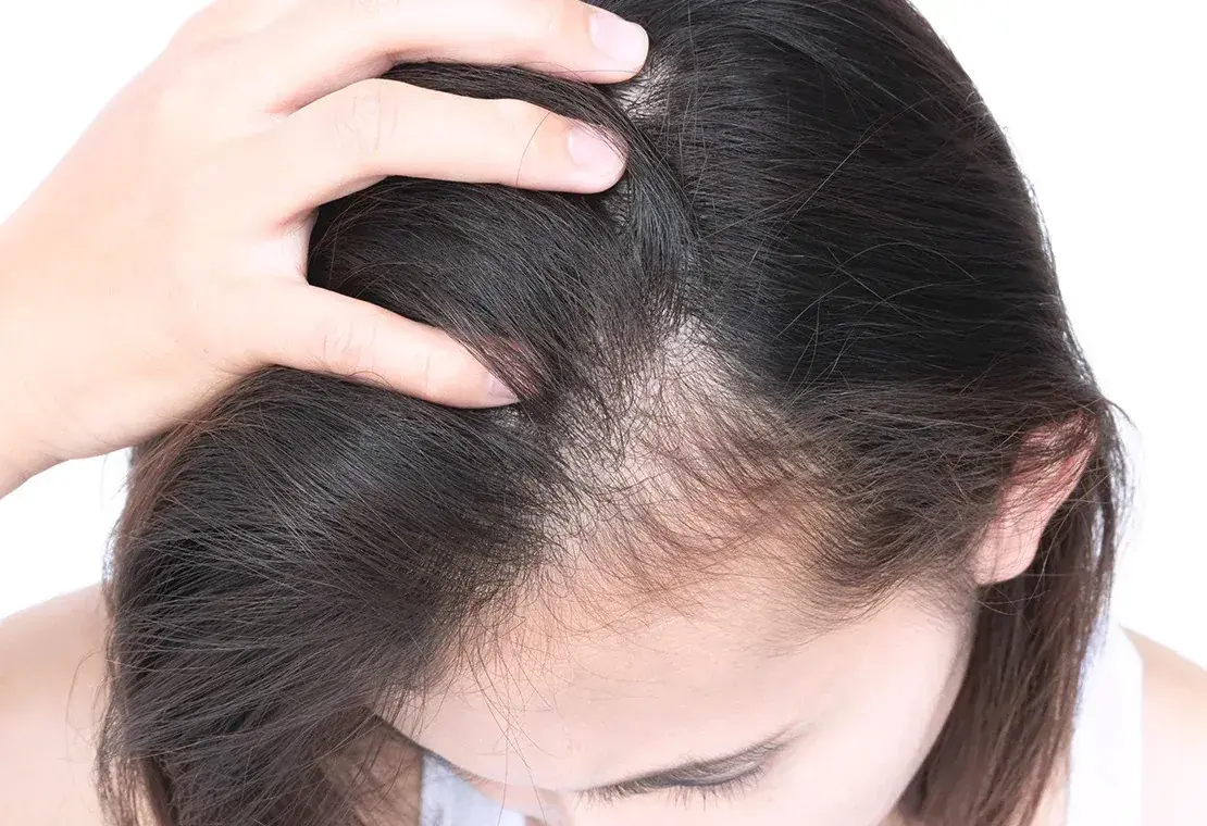 اسکالپ سر – میکروبلیدینگ ابرو – بن مژه