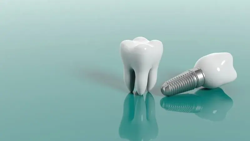 ایمپلنت چند دندان، عوارض و مراقبت بعد از آن