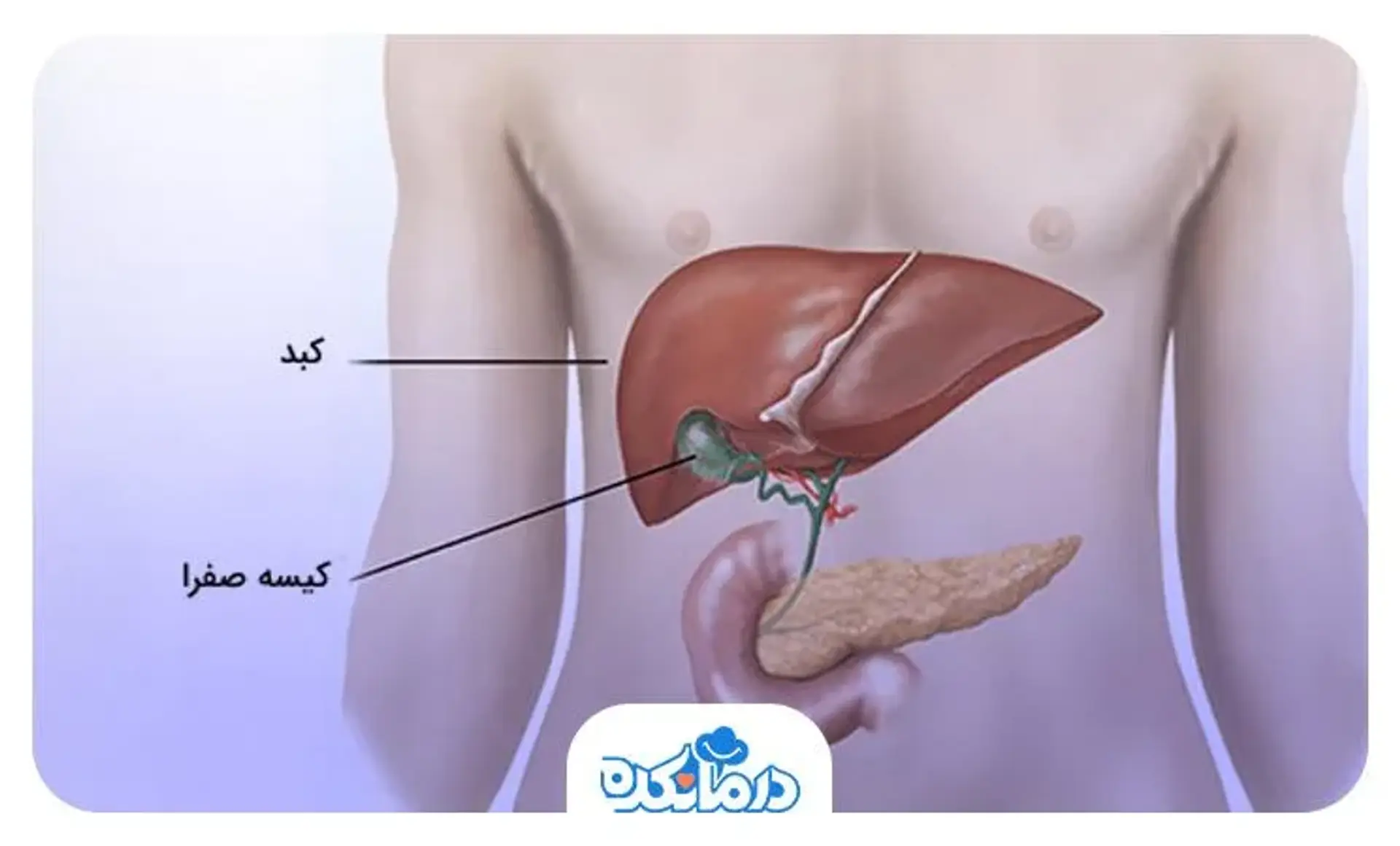 کوله سیستیت حاد یا Acute Cholecystitis چیست؟