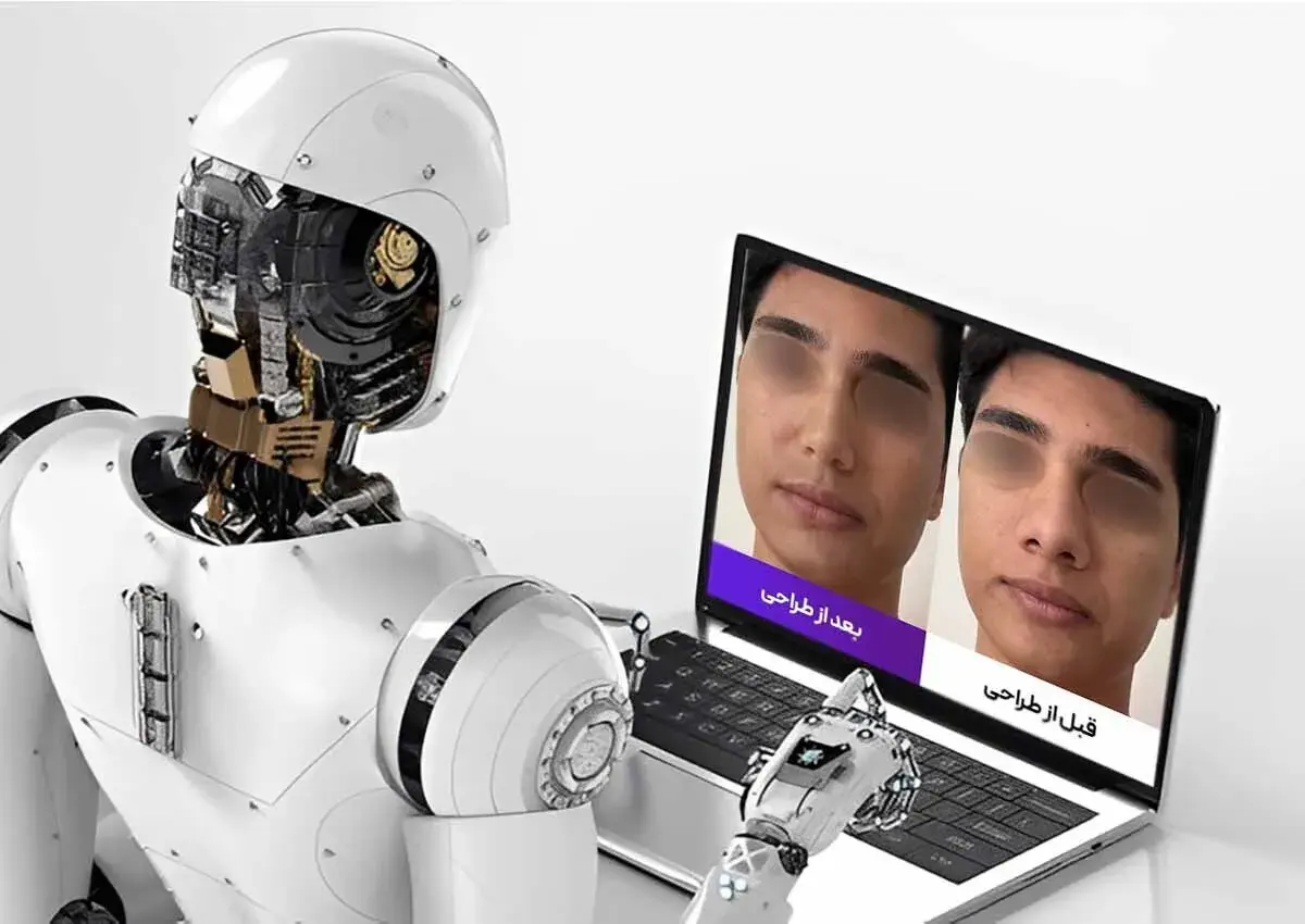 جراحی بینی در تهران با پزشک 24