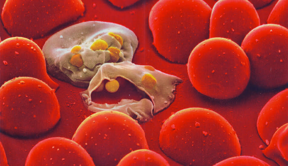 انتقال مالاریا