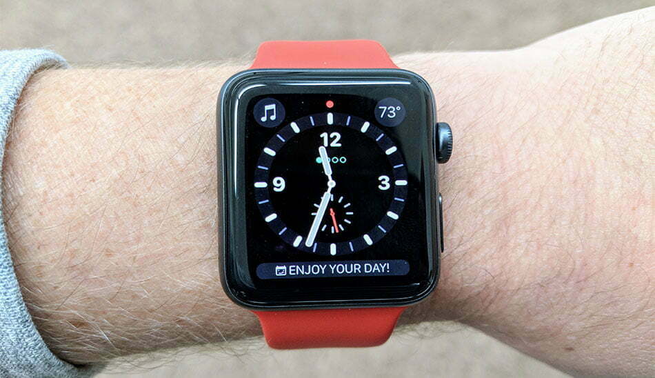 apple watch / اپل واچ