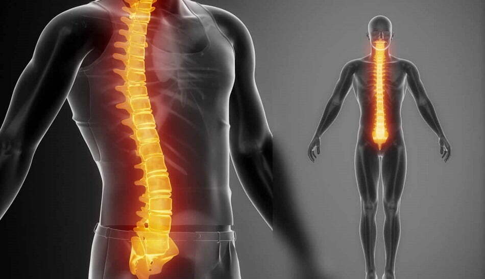 فلج چیست / فلج به انگلیسی