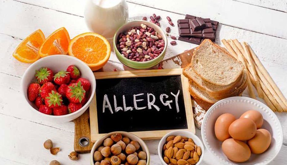 حساسیت غذایی/ food allergy