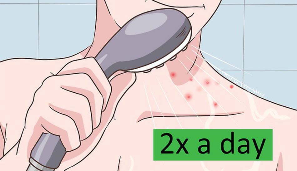برای داشتن پوستی صاف و بدون جوش