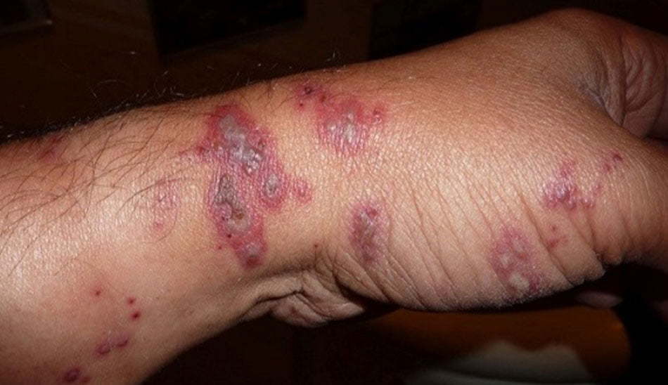 طاعون خیارکی چین
