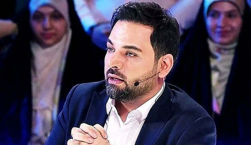 احسان علیخانی قبل از کاشت مو