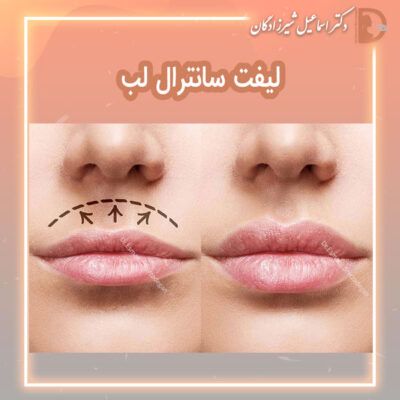 دکتر شیرزادگان