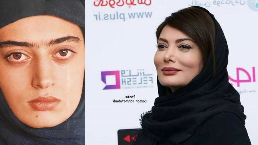 جراحی های زیبایی معروف ترین بازیگران ایران