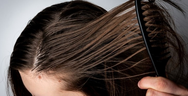 پاکسازی موهای چرب